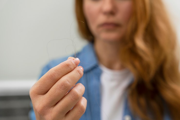 caduta di capelli ecco i motivi, tutti i dettagli