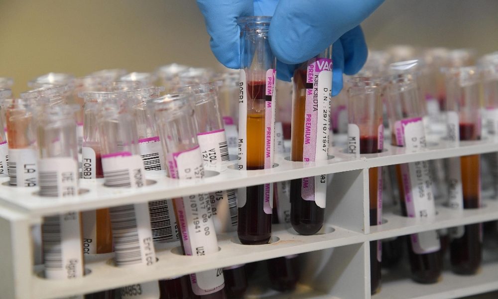 Ancora su contagi Covid, + 223. 15 morti