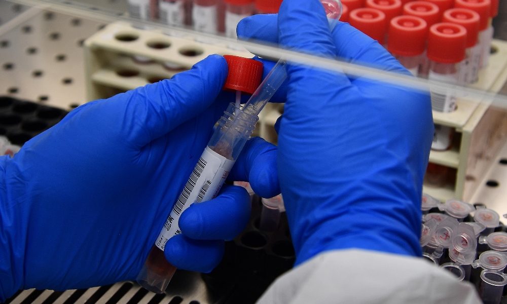 Coronavirus, 6 positivi in Campania