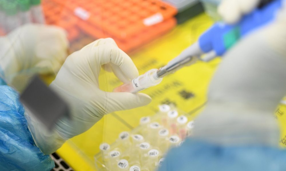 Coppia cinesi ancora terapia intensiva