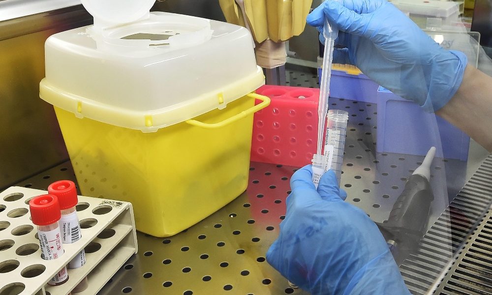 Coronavirus: 154 vittime in Piemonte, 2341 i positivi