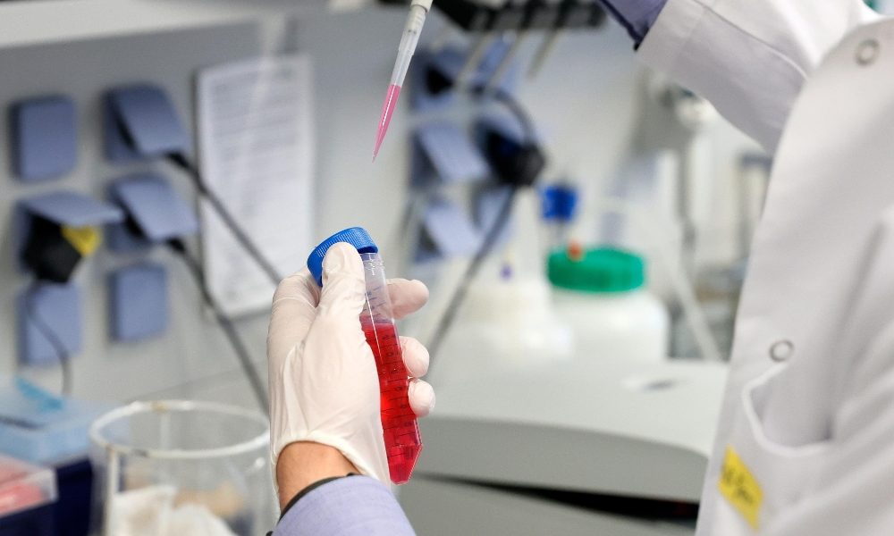 Coronavirus, 65 vittime in ultime 24 ore