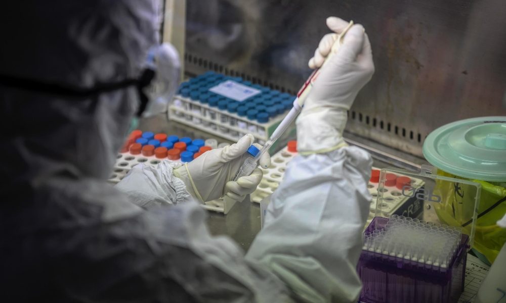 Cantù, positivi tre medici e due infermieri. Sul Lario i contagi toccano ora quota 256