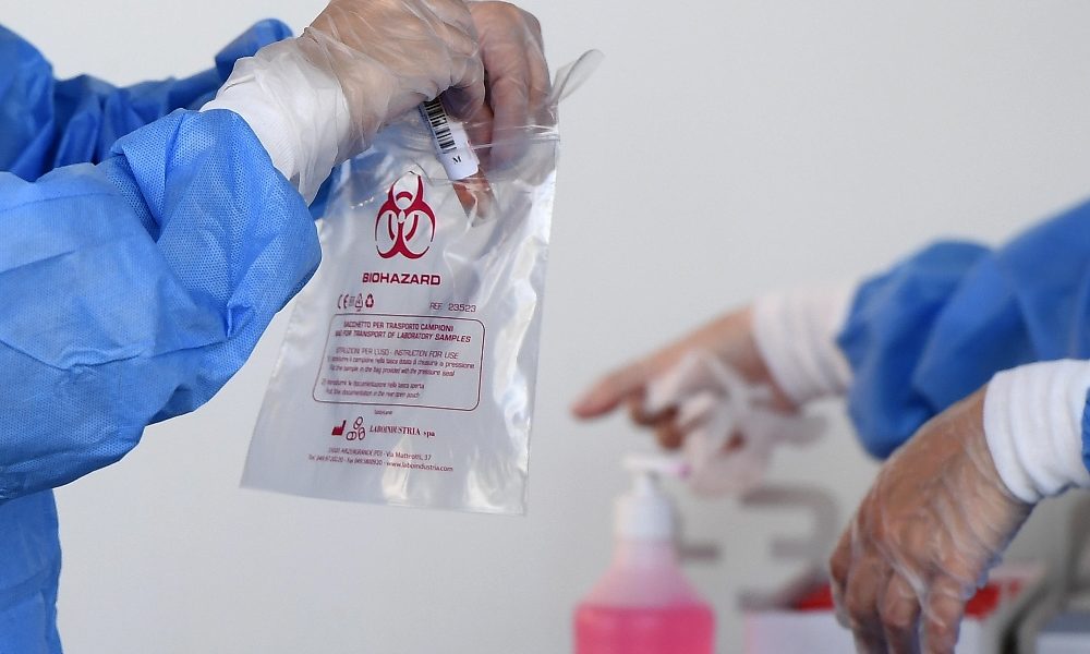 Covid, l’esperto Tosi, numeri alti ancora per due settimane
