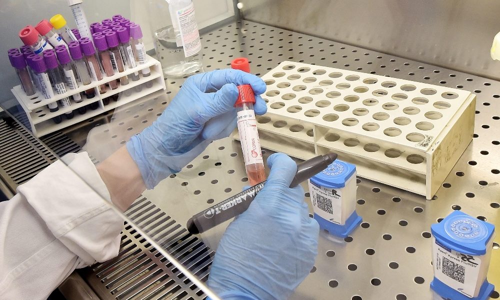 Coronavirus: donna positiva a Catania
