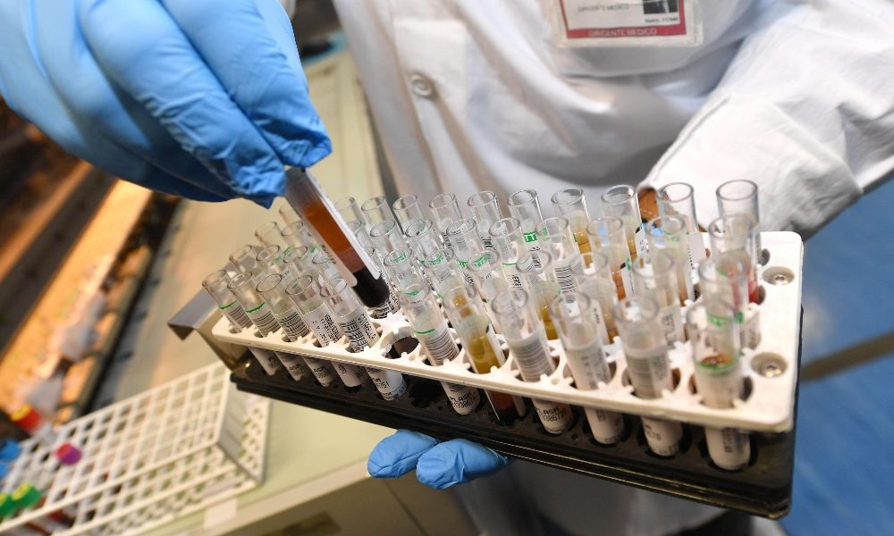 Coronavirus, due tamponi positivi Marche