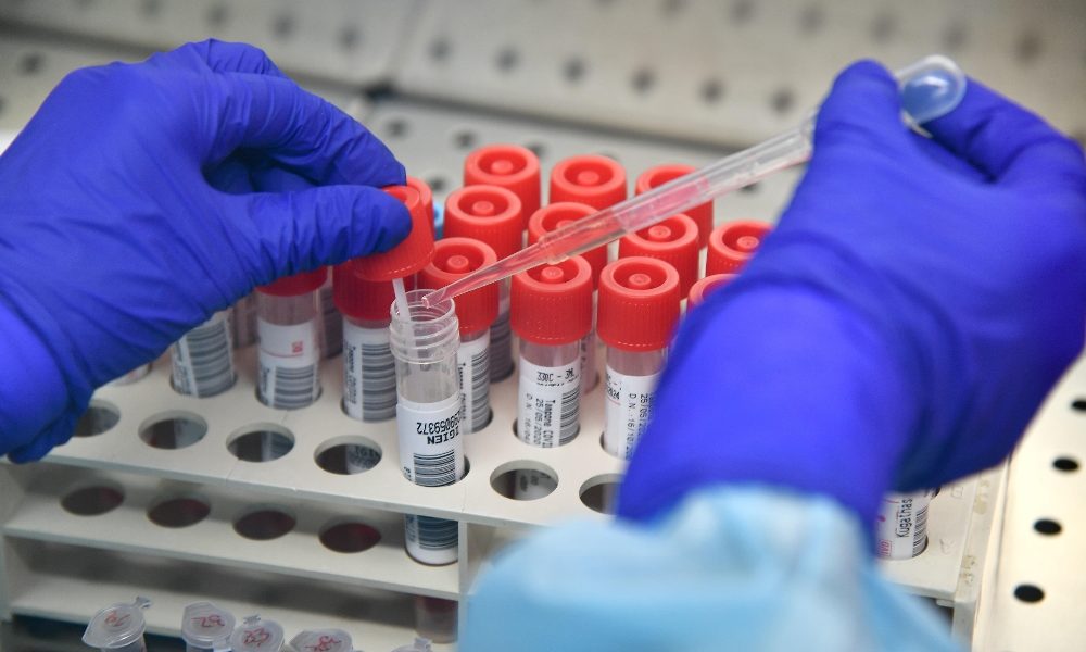 Coronavirus, per il terzo giorno consecutivo 5 nuovi casi nel Comasco