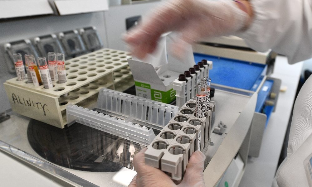 Coronavirus: primo caso in Puglia