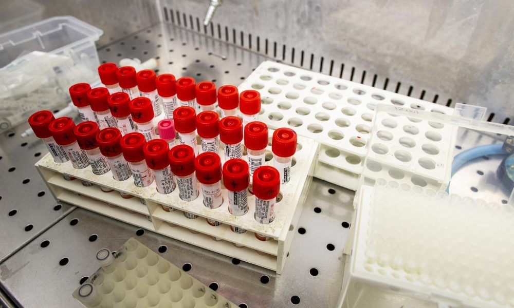 Coronavirus: primo decesso in Oristanese