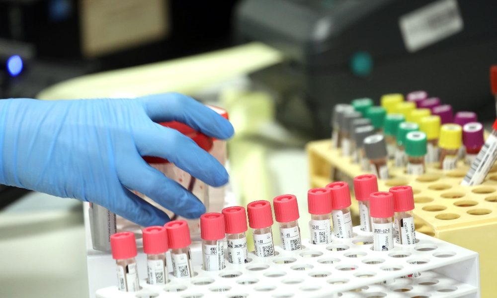 Coronavirus: stati Firenze 2 ricoverati
