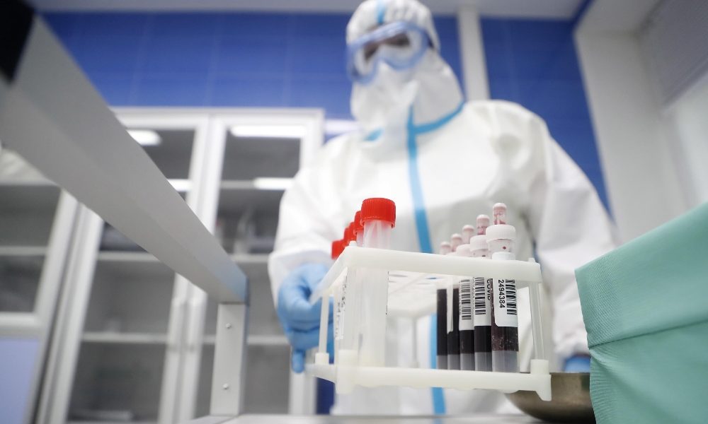 Covid-19 a Como, 9 contagi ma nessuna nuova vittima. Dall’inizio della pandemia i positivi sul Lario sono stati 3.921