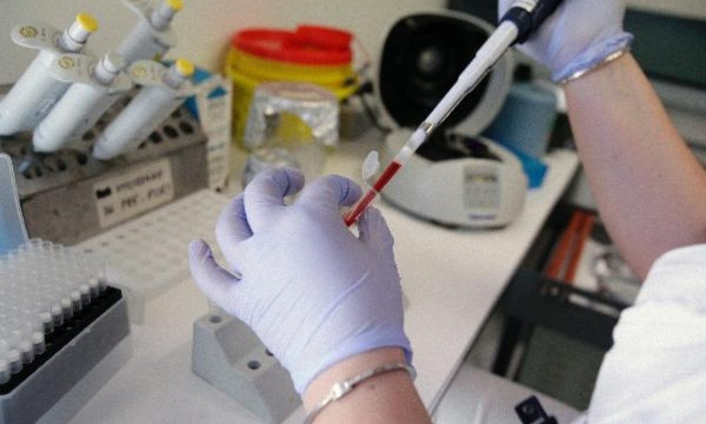 Coronavirus, c’è un nuovo caso comasco nella Bassa. Pensionato positivo al primo tampone