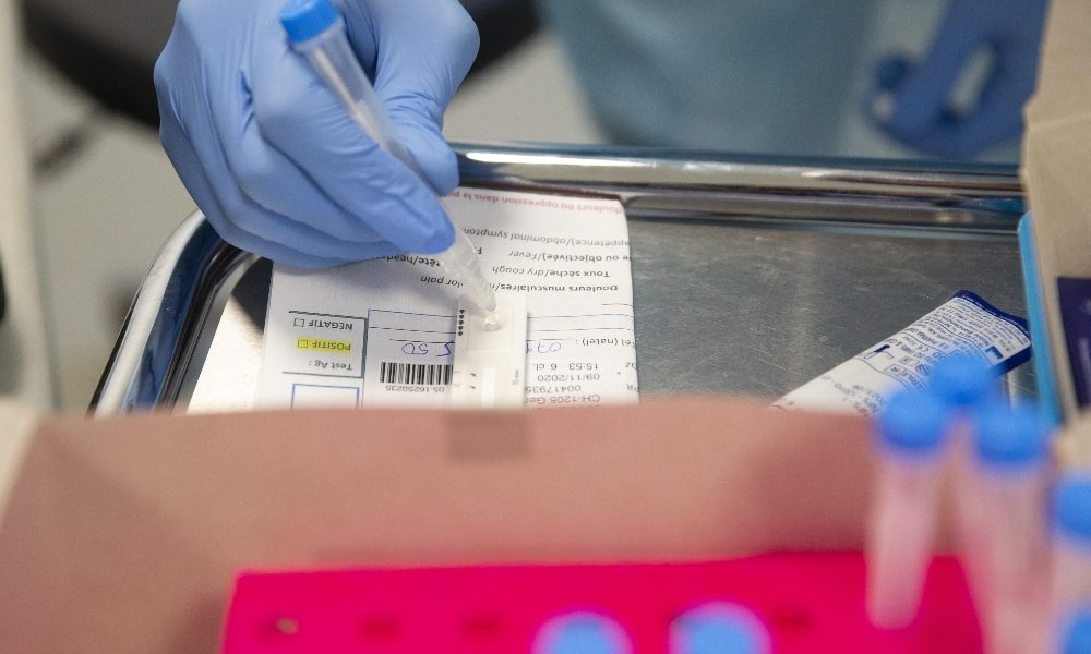 Covid: 2 decessi in Alto Adige e 175 nuovi positivi