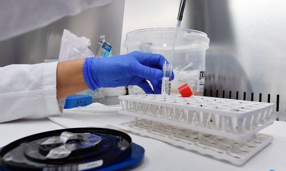 Covid: Marche, 238 casi in un giorno su 1.026 nuove diagnosi