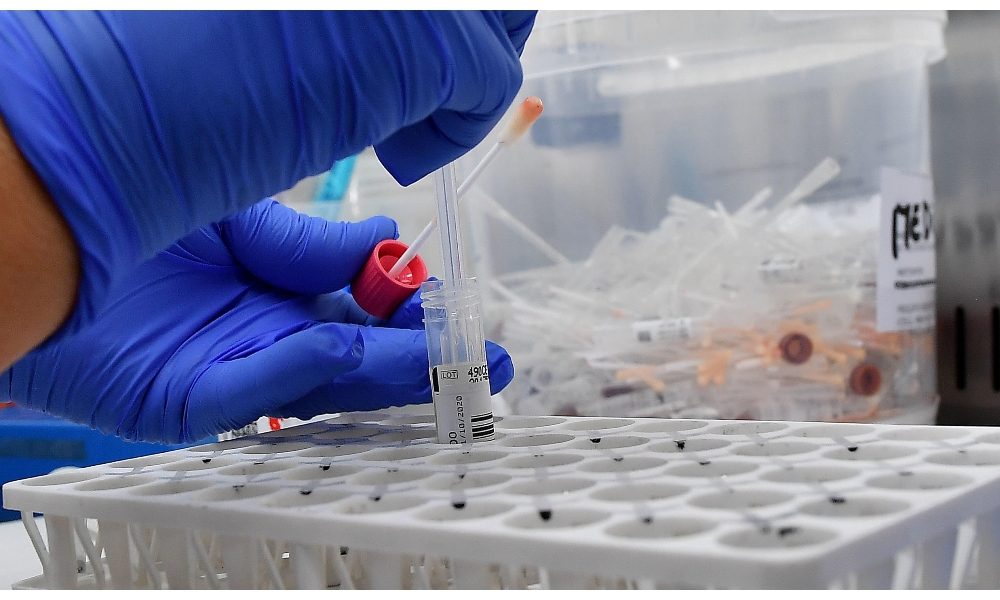 Covid: Marche, 479 positivi in 24ore su 1.789 nuove diagnosi
