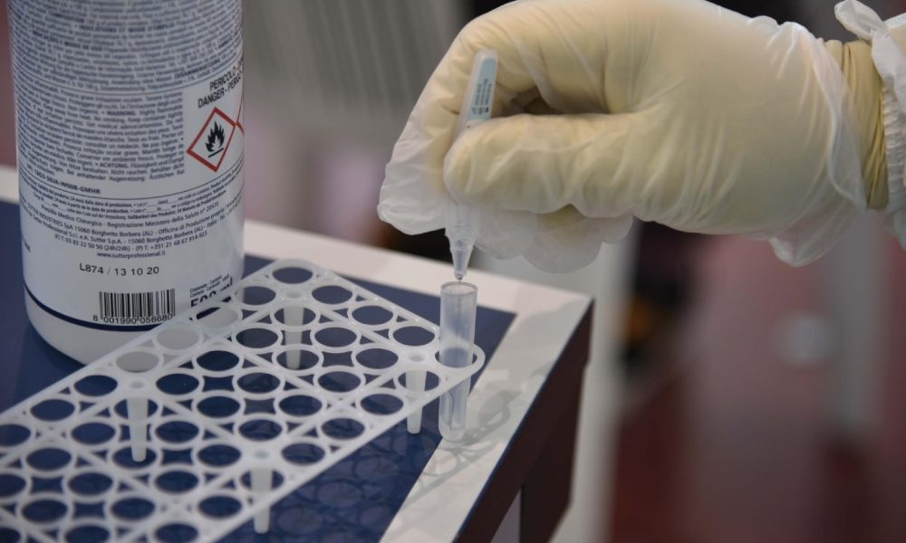 Covid: Marche, 688 casi da ‘molecolari’, 109 da test rapidi