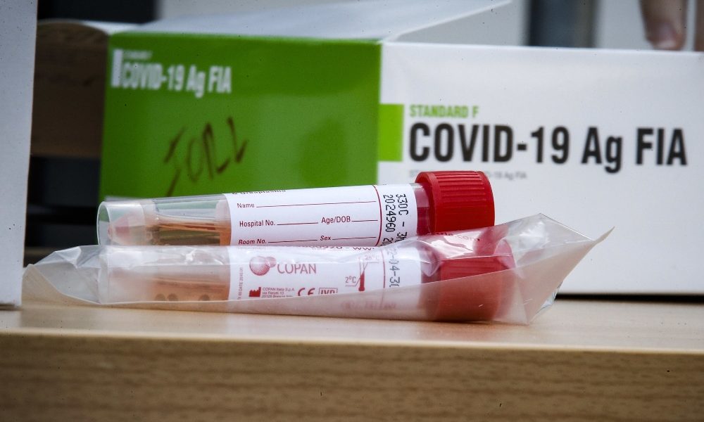 In Svizzera oltre 10mila casi di Coronavirus in un solo giorno. E i dati del Canton Ticino preoccupano
