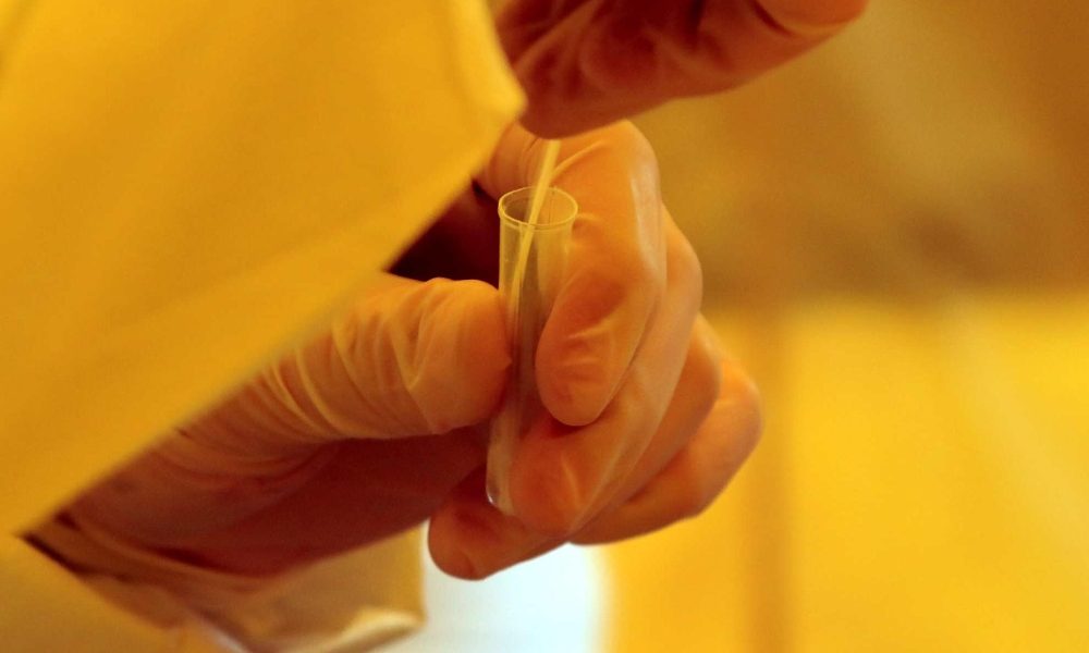 Covid: calo positivi e vittime,ma oltre 75 mila test in meno