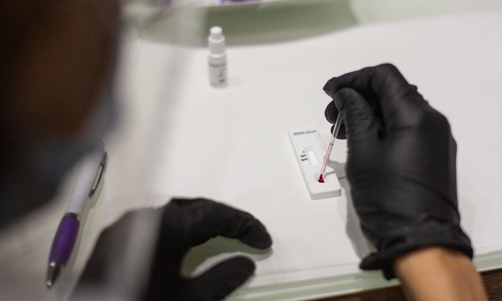 Covid: in Slovenia positivo 18,5% dei test,scatta coprifuoco