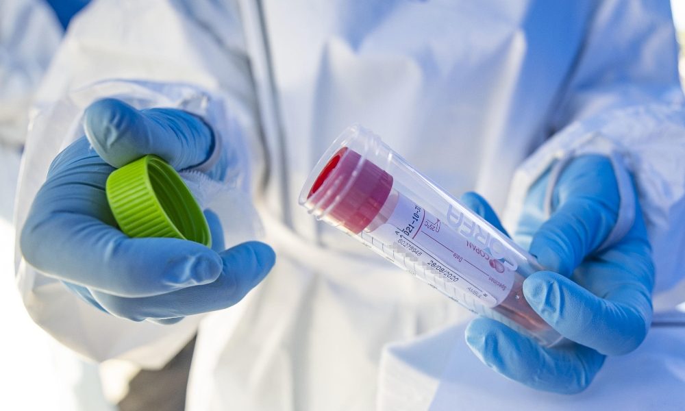 Covid-19, sono sette i nuovi positivi nel Comasco