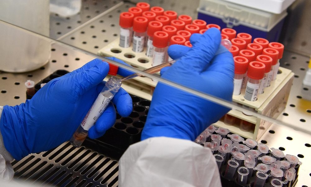 Coronavirus, un solo nuovo caso nel Comasco. Nessun decesso in Lombardia