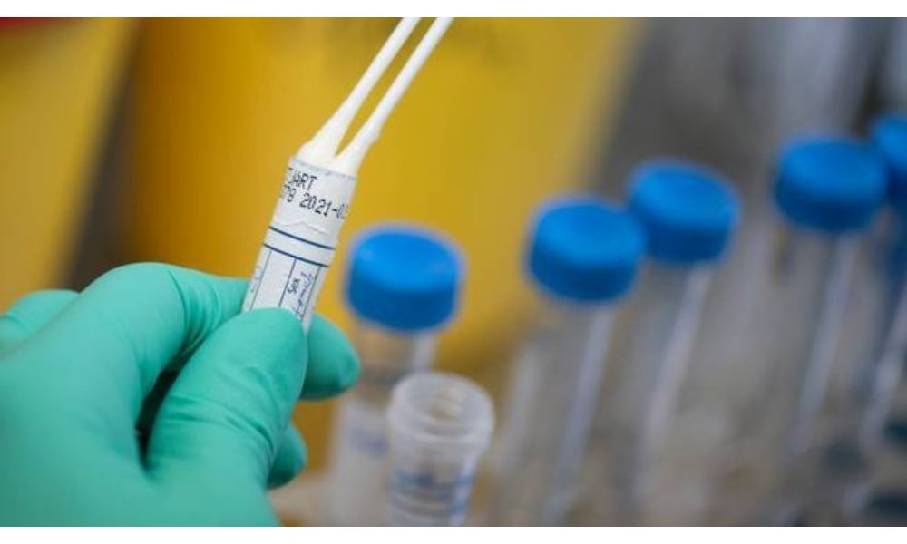 Covid: ospedale Pascale di Napoli, si sperimenta test rapido