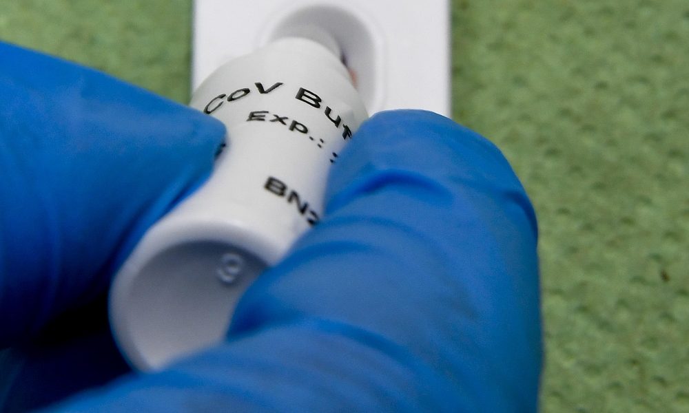 L’amara lettera dei medici alla Regione: «Non possiamo fare i test negli ambulatori»