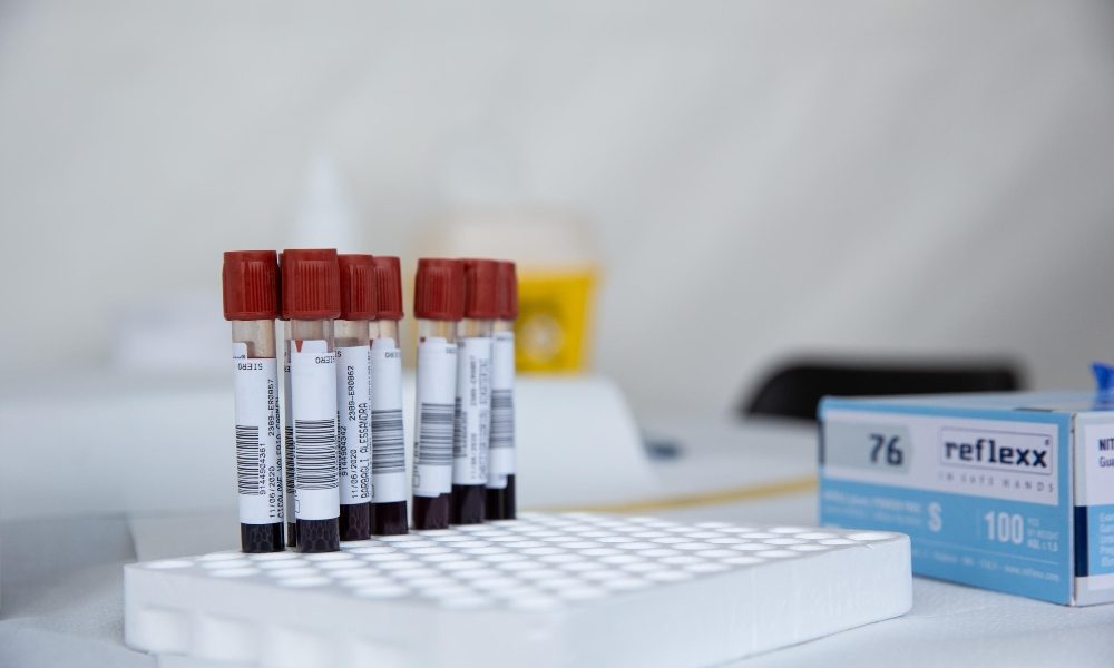 Coronavirus, 10 nuovi positivi in provincia di Como