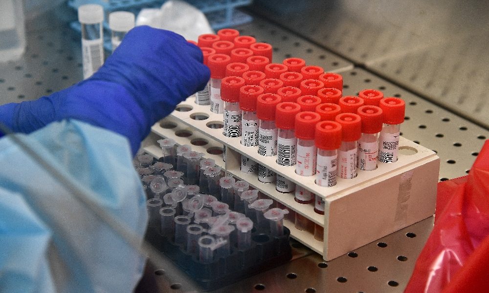 Coronavirus, anche oggi otto nuovi casi sul Lario