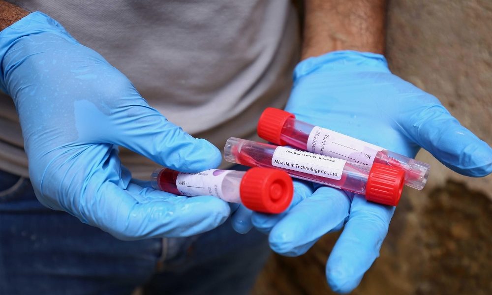 Covid, sul Lario 182 nuovi casi e due deceduti