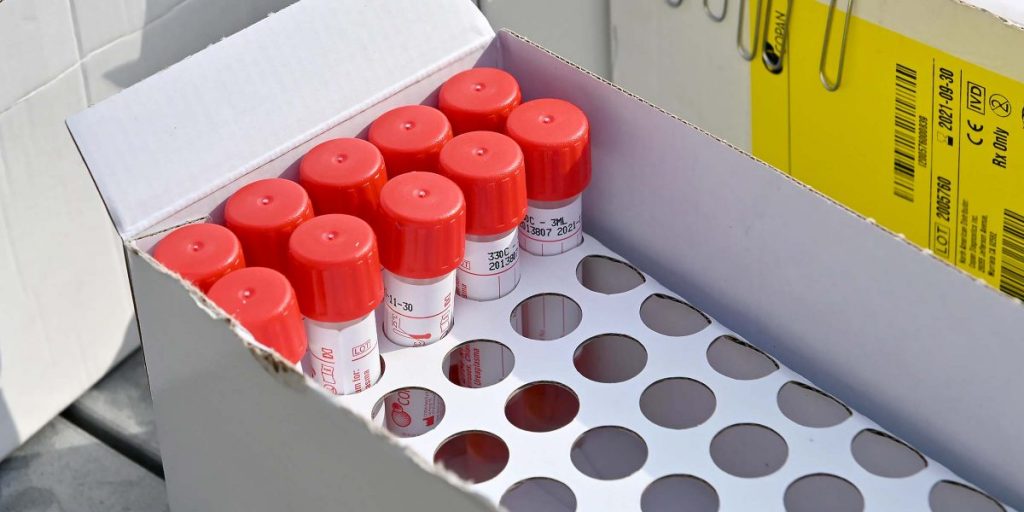 Altri 6 decessi e 152 contagi, Como mantiene un’alta incidenza