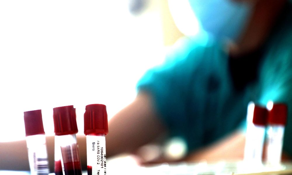 DiaSorin, no indagati epidemia colposa