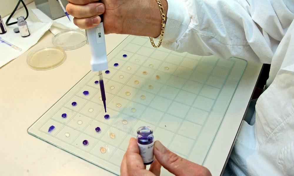 In Germania si lavora a test anticorpi
