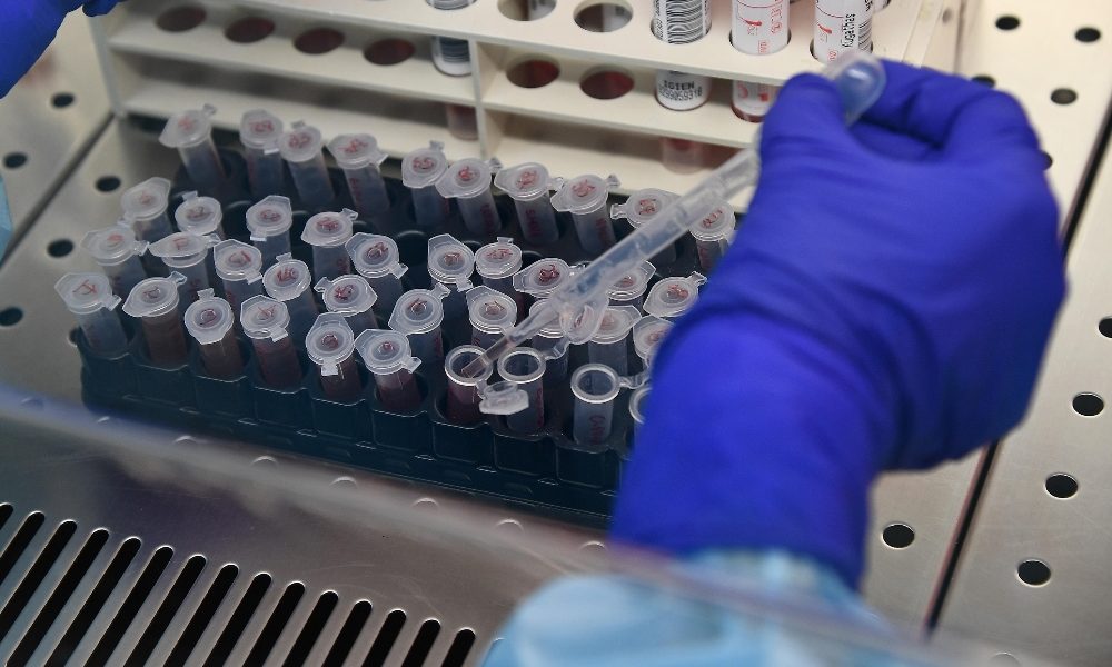 Coronavirus, in Lombardia 125 positivi e 21 morti